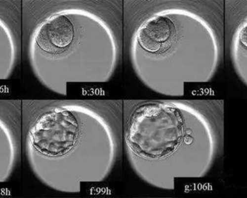香港直通车平台预约验血,美国试管婴儿专家给大龄女性的备孕小妙招!(中)