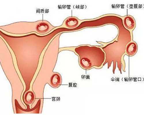 怎么去香港查宝宝性别?验血的条件要全部满足,怀孕到香港去验血怎么弄