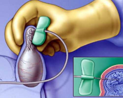 四个月香港验血不准_几周可以验血_寄血过去可靠吗性别鉴定