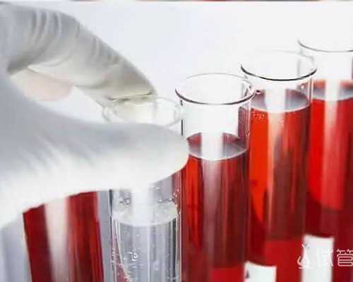 长沙有上门收购古玩的吗,膝关节半月板损伤一定要手术吗