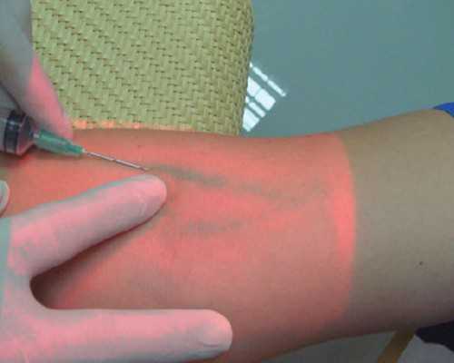 香港男女验血报告,不孕不育咨询：子宫内膜薄厚影响受孕