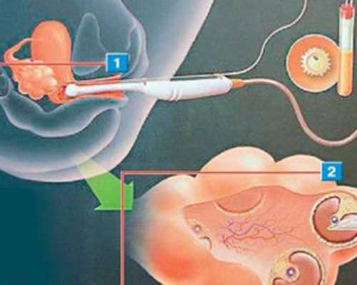 古玩拍卖会图片,肺癌晚期无力怎么补充营养