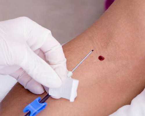 香港pg验血化验所官网,多年备孕无果,到底应不应该选择试管婴儿?