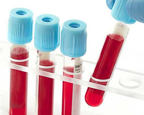 怀孕香港验血报告单怎么看,备孕饮食别乱补 科学合理才是王道