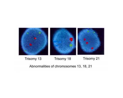 香港验血九个D有准吗,试管方案的ivm技术是属于第几代试管?