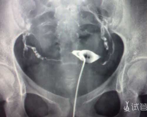 内地邮寄去香港验血的程序
 可以去香港鉴定胎儿性别吗?想知道准不准关键的都