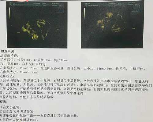 我的怀孕经历和香港验血报告,二胎香港验血是女孩_测性别选择哪家!