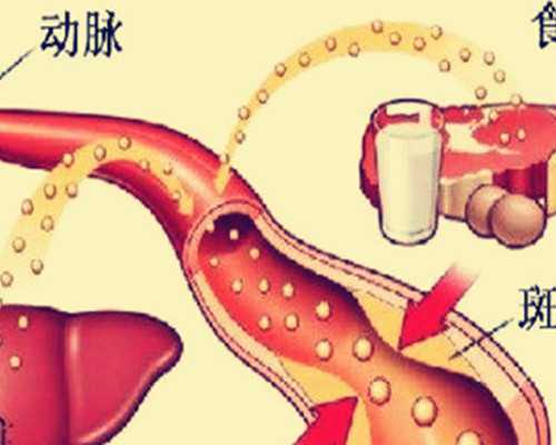 古玩人生可大可小宋慎_苦瓜减肥法与食谱 7天甩肉5kg没问题