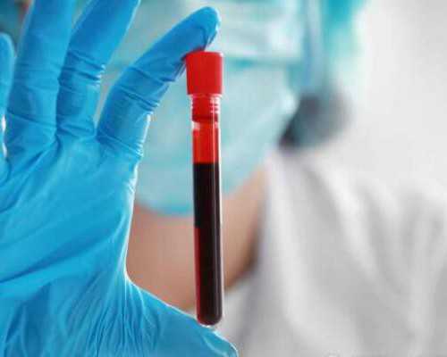 验血查病毒多少钱，揭晓2024验血的所有相关事项,怀孕到香港验血要注意什么意