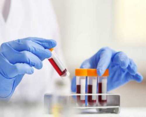 香港验血邮寄违法吗,女性经期乳房胀痛 小心是不孕的先兆