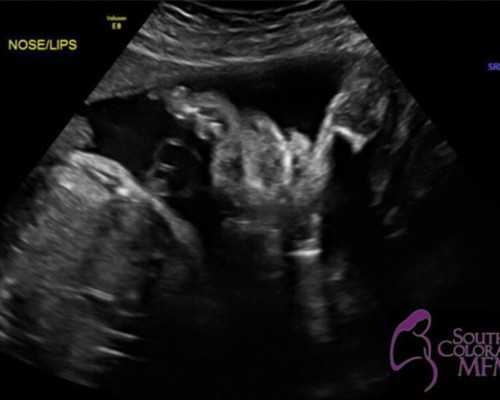 内地能邮寄香港验血么,排卵前一天同房要去香港验血查男女_鉴定哪家准确率最