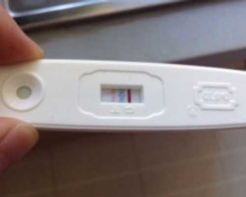 古玩收藏交易群,腰椎滑脱微创手术费用