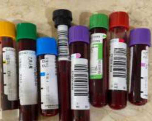 怀孕香港验血要几天_染色体结果多久出来_你最担心的问题答案都在这