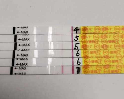 香港哪些医院可以验血男女_传统文化剪纸资料中国传统文化 剪纸
