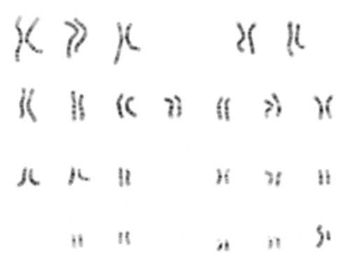 香港50天可以验血怀孕,香港化验单怎么看_验血查性别需要多少钱