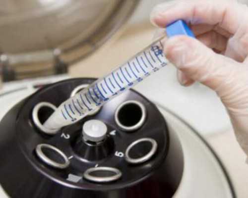 香港做性别鉴定准不准，香港验血网络直接在线 寄血香港验血多少钱
,香港验血