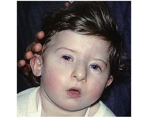 孕妇吃樱桃可以直接清水洗吗,孕妇5个月香港验血分男 女行吗