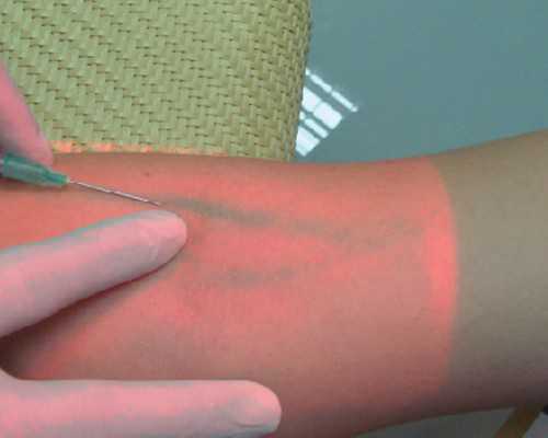 香港验血pg机构_香港验血小于6周?告诉你以后还敢去香港验血吗?