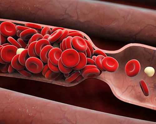 贵阳市古玩鉴定交易中心_如何提升握力?