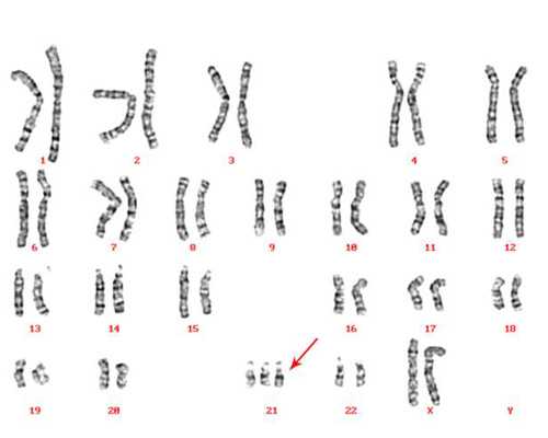 香港验血机构多吗_为你总结2025我的成功验血的经 香港验血哪几家机构是正规的
