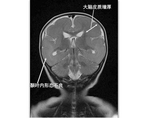 dna鉴定胎儿性别什么原理
 哺育两个儿子的注意事项,记着暗访香港验血生男女